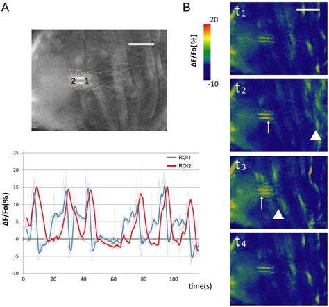 Calcium Imaging In Chordotonal Organs During Muscle Contractions