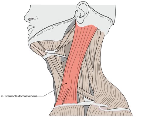 The Sternocleidomastoid Muscle - a culprit of widespread muscle pain | hubpages