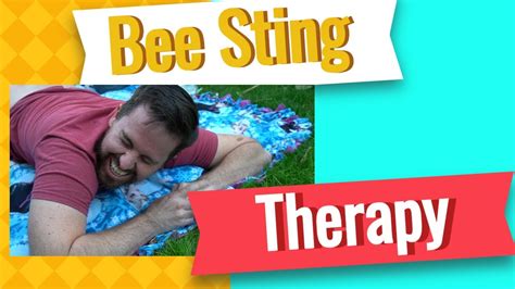 Bee Sting Therapy Apitherapy On My Back Youtube