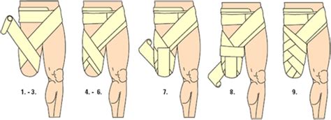 STUMP BANDAGING FOR ABOVE AND BELOW KNEE AMPUTATION | Physical therapy ...