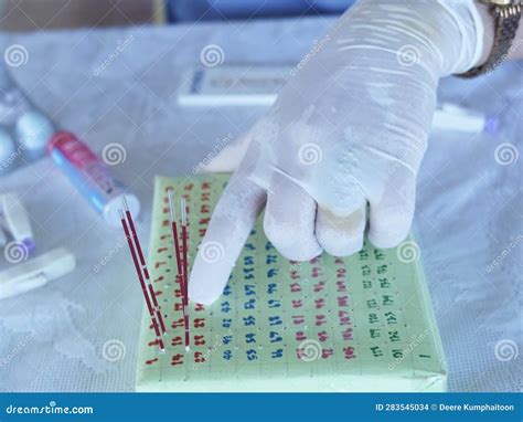 HCT ,hematocrit Hct Blood Test, Hematocrit Centrifuge Plate with ...