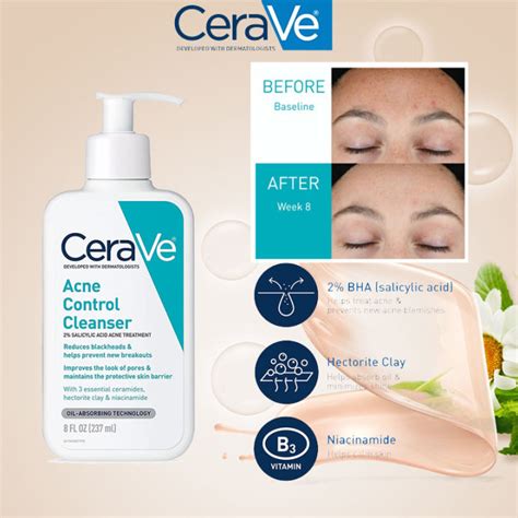 Cerave Acne Control Cleanser 2 Salicylic Acid Acne Treatment Cleanser 237ml Improve Skin