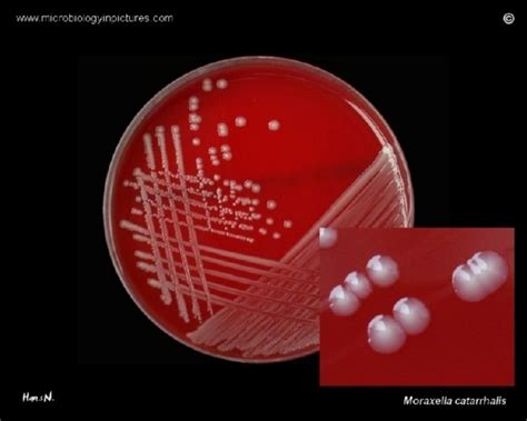 Moraxella catarrhalis on agar plate. M.catarrhalis bacteria culture on ...