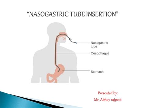 Nasogastric Tube Ng Tube Ppt