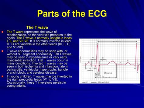 Ppt Ecg Basics Powerpoint Presentation Free Download Id6029627