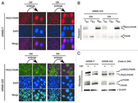 Level Of Phosphorylated PAX3 FKHR Is Increased In The Nucleus Of ARMS