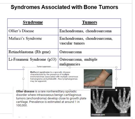 BONE TUMORS Flashcards Quizlet