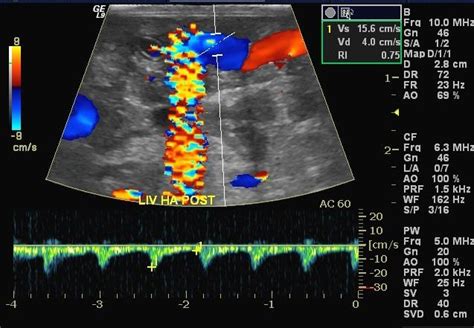 Noise Artifacts In Diagnostic Ultrasound Innovatus Imaging