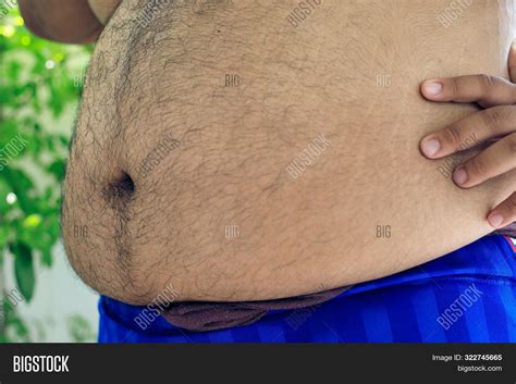 Imagen Y Foto Navel Fat People Prueba Gratis Bigstock