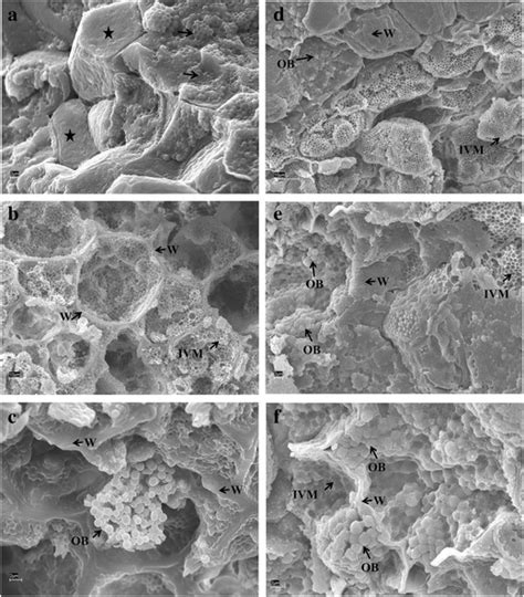 Scanning Electron Microscopy Analysis Of Mature Endosperm And