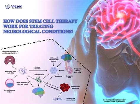 How Does Stem Cell Therapy Treating Neurological Conditions