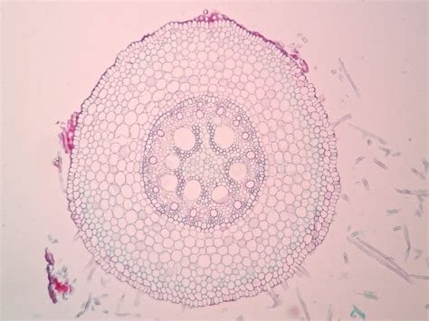 Cross Sections Of Plants Stem Show Plant Vascular Tissue Under Microscope View Stock Image