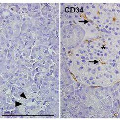 Immunohistochemical Analyses Of Nestin And Cd In Normal Human