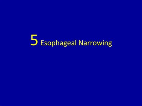esophageal narrowing pptx