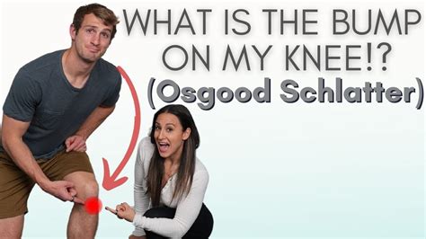 Osgood Schlatter Whats This Bump On The Front Of My Knee Youtube