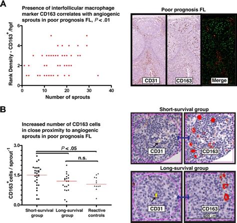 Elevated Cd163 Macrophages Correlate And Are In Close Proximity With Download Scientific