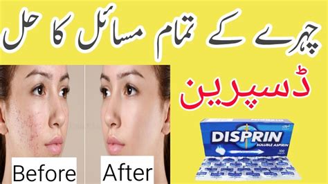 Disprin Tablet For Skin Freshness And Anti Acne How To Use Disprin As