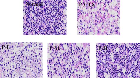 Effects Of Hlp On The Spleen Tissues In The He Stained Download Scientific Diagram