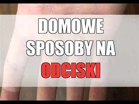 ODCISKI NAGNIOTKI DOMOWE SPOSOBY YouTube