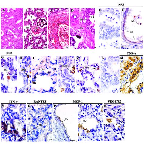 Histopathological And Immunohistochemistry Analysis Of The Lung A