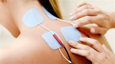 Electroterapia en Fisioterapia Definición y Beneficios DrFisio