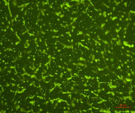 Fluorescence Micrographs Of Different Bitumens Modified With 5 Wt Sbs