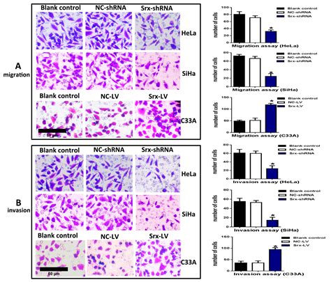 IJMS Free Full Text Sulfiredoxin May Promote Cervical Cancer