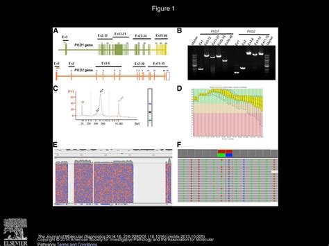 Molecular Diagnosis Of Autosomal Dominant Polycystic Kidney Disease