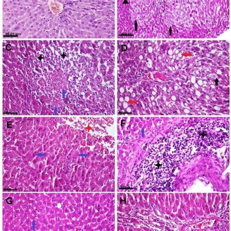 Photomicrograph Of Adult Male Albino Wistar Rat Liver Tissue Sections