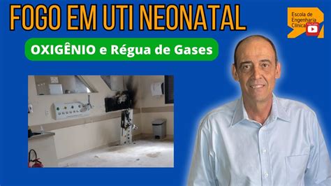 Inc Ndio Em Uti Neonatal Oxig Nio Em R Gua De Gases Curto Circuito E