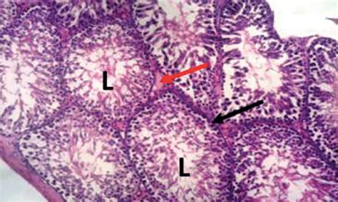 Photomicrograph Of The Testes Of A Control Rat Showing Normal Testes Download Scientific