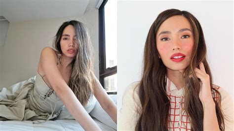 Martine Ho Opens Up About Her Struggles With Facial Paralysis Preview Ph