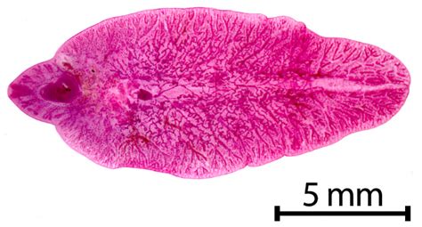 liver flukes