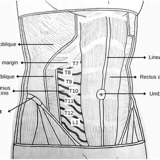 Surgeon Administered Transversus Abdominis Plane Block Anatomic