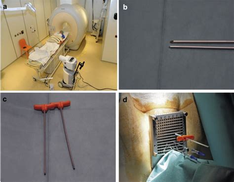 The Effect Of Catheter Displacement And Anatomical Variations On The