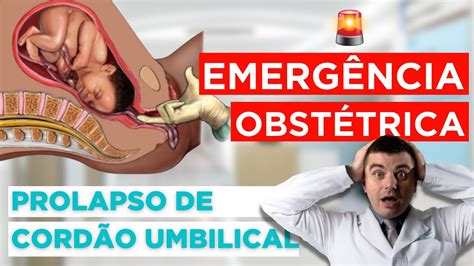 EMERGÊNCIA Prolapso de Cordão Umbilical YouTube