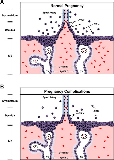 Table 1 1 From The Role Of Abnormal Maternal Inflammation In The