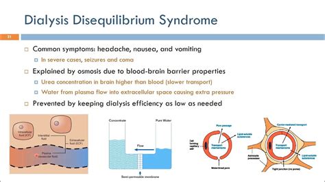 Short Topics in Hemodialysis: Dialysis Disequilibrium Syndrome (Arabic ...