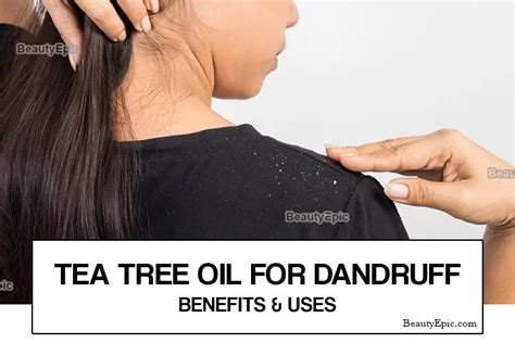 Tea Tree Oil For Dandruff: Uses And Benefits