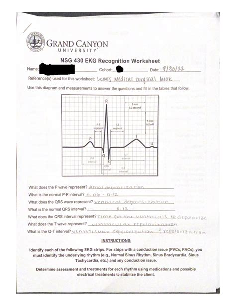 ECG ECG Worksheet Answers NSG 430 Studocu