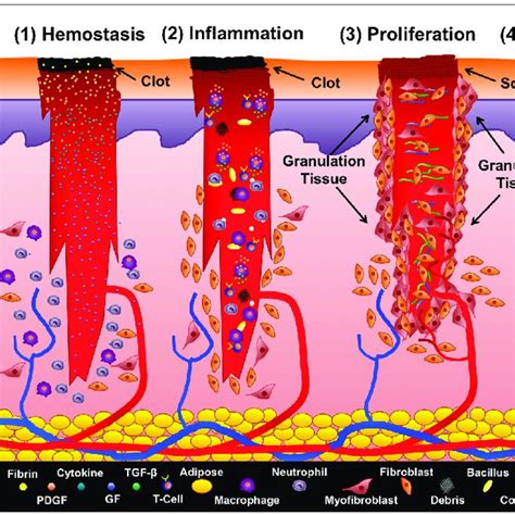 Surgical Wound Healing Stages