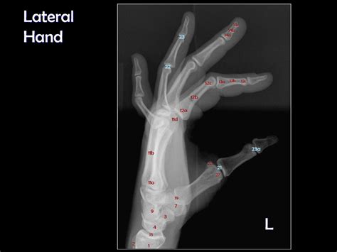 Lateral Hand View Diagram Quizlet