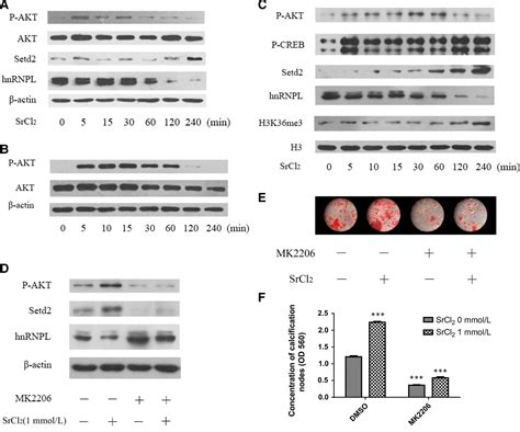 Hnrnpl Inhibits The Osteogenic Differentiation Of Pdlcs Stimulated By