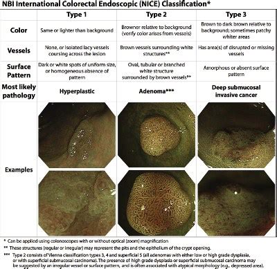 Classificação de NICE Narrow Band Imaging International Colorectal