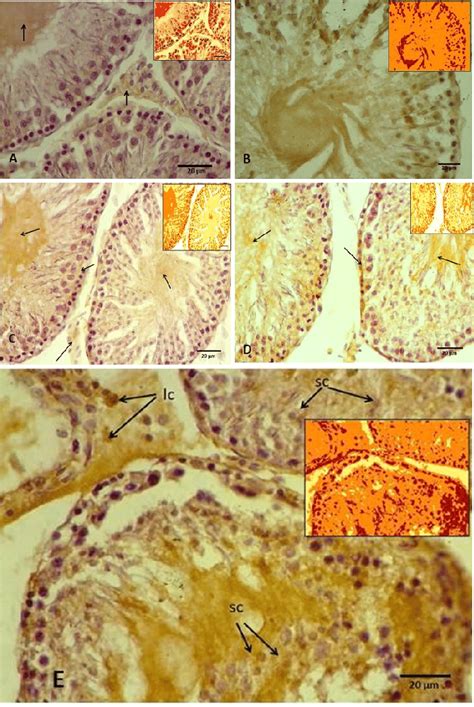 The Immunohistochemical Micrography Of Testicular Tissues A Control