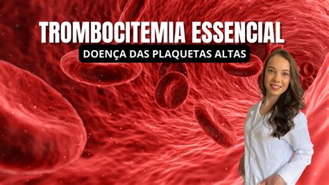 Trombocitemia Essencial Plaquetas Altas YouTube