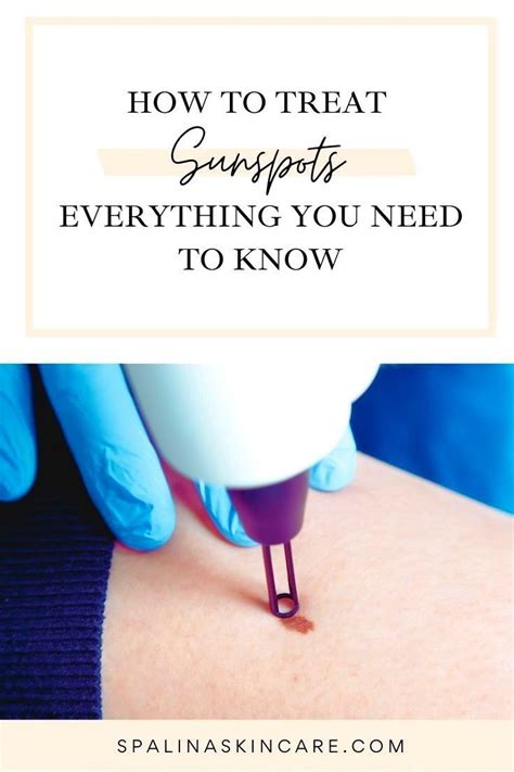 How To Treat Sunspots Everything You Need To Know By Spalina Inc