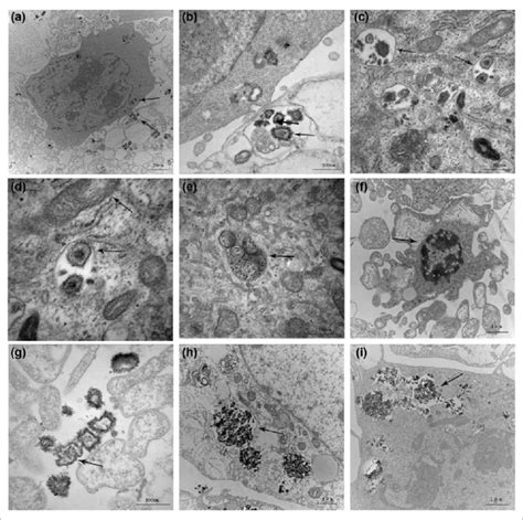 Transmission Electron Micrographs Of Ej Cells Exposed To Ag Cnps Or