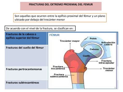 Fracturas Del Extremo Proximal Del Femur