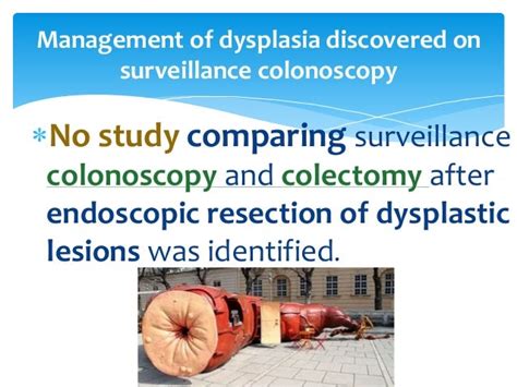 Colorectal Cancer Surveillance In Ibd 2015